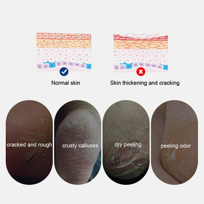 1 Pair Heel Moisturizing Sleeves
