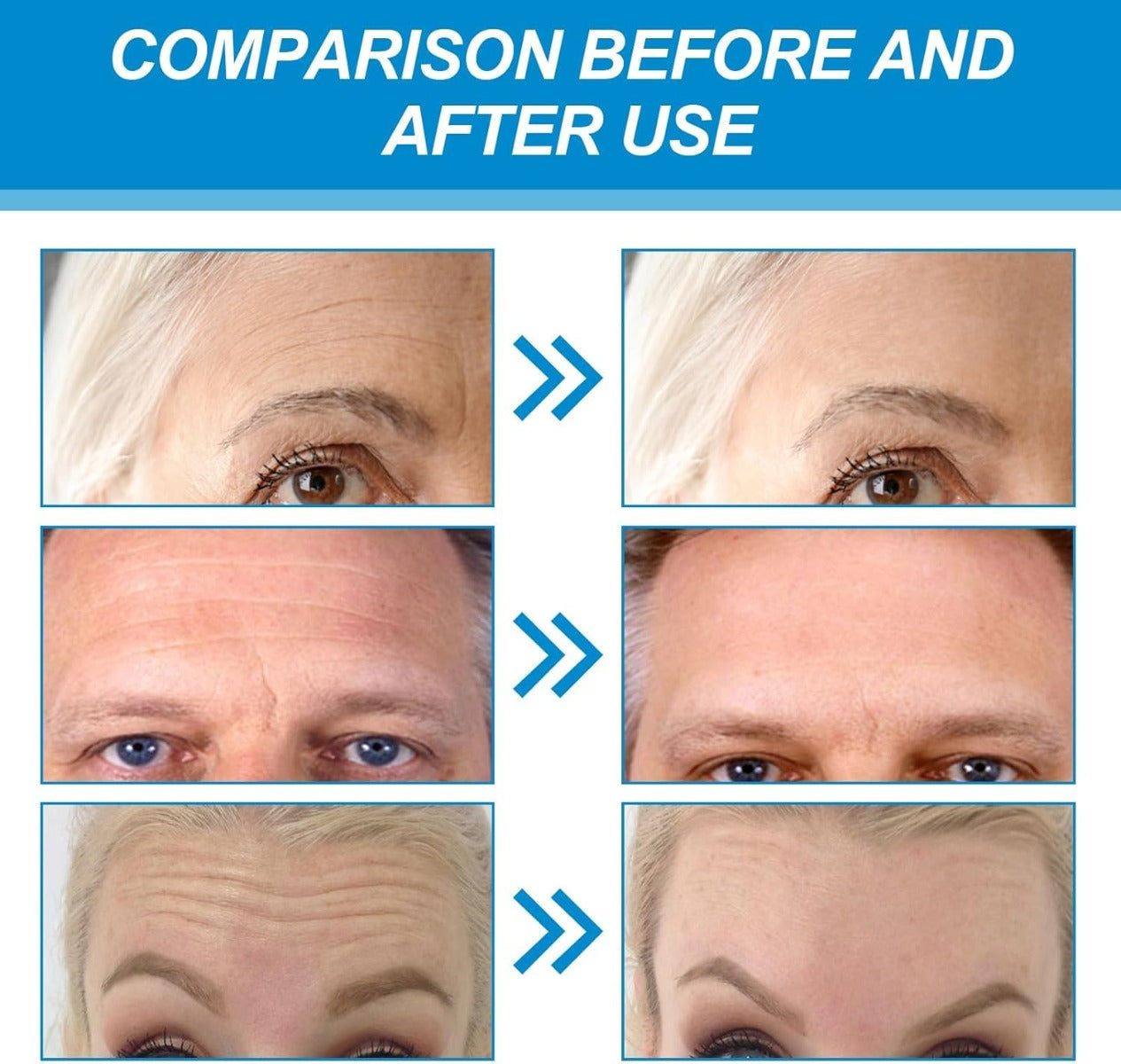 Forehead Patch Forehead Line Gel Patch