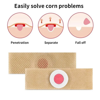 6Pcs Corn Remover Pads With tool