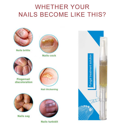 Nail lotion a bright biological repair fluid nail care fluid