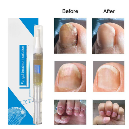 Nail lotion a bright biological repair fluid nail care fluid