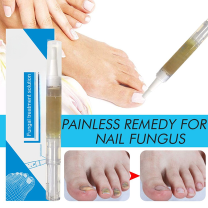 Nail lotion a bright biological repair fluid nail care fluid