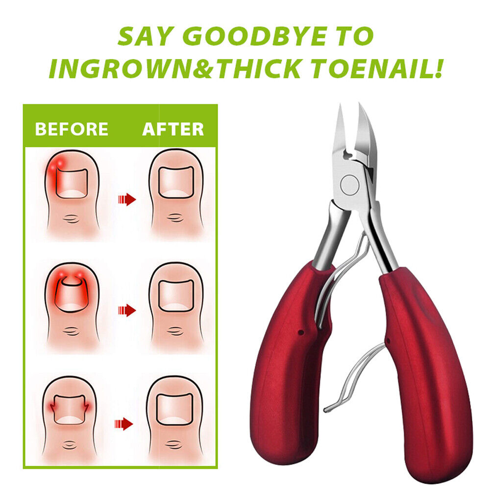 Toe Nail Clippers